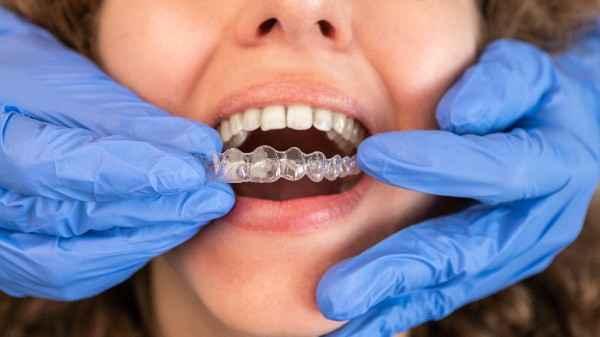 orthodontist Brighton